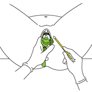 Pelvic Examination