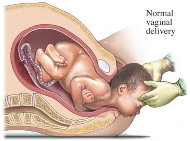 Childbirth