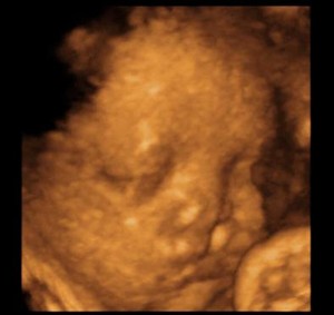 Ultrasound Scan