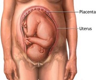 Placental Abruptions Diagram
