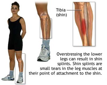 pain front lower leg