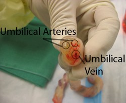 SUA check after birth