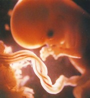 picture of umbilical cord in womb